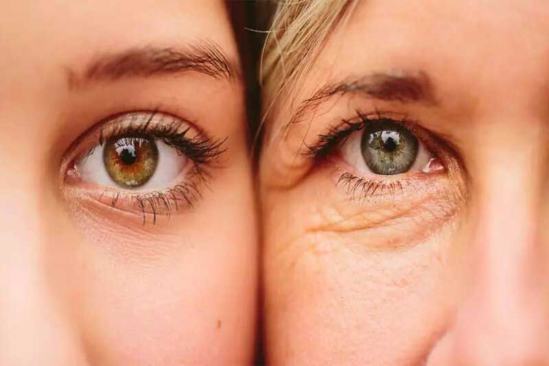 آنچه باید در مورد پیر شدن چشم‌ها بدانیم
