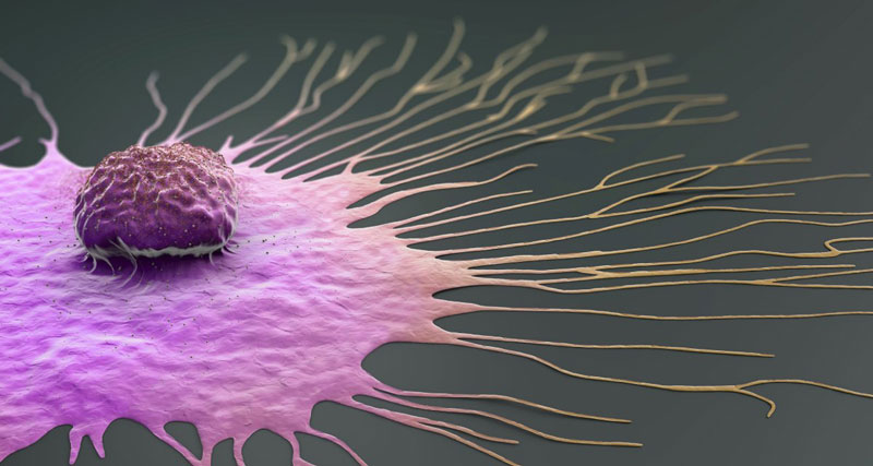سالانه ۲.۳ میلیون زن در جهان به سرطان سینه مبتلا می‌شوند