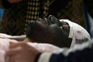 چهارشنبه سوری را به غمگینترین روز عمرتان تبدیل نکنید/ برای حفظ سلامتی، نکات ایمنی در مراسم چهارشنبهسوری رعایت شود