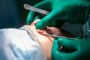 جراح زیبایی اینستاگرامی باعث طلاق چندین زن شد!