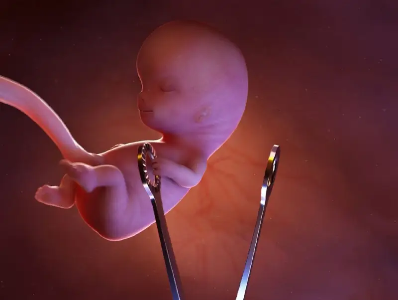 «سقط جنین»؛ سیاهچاله پیامدهای فردی و اجتماعی